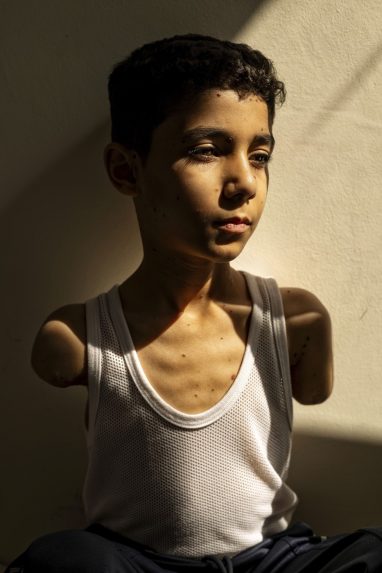 Na snímke víťazná fotografia chlapca bez rúk.